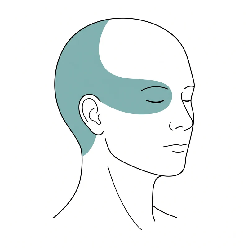 Head diagram: pain shaded from the base of the skull up over one side and forward behind the eye
